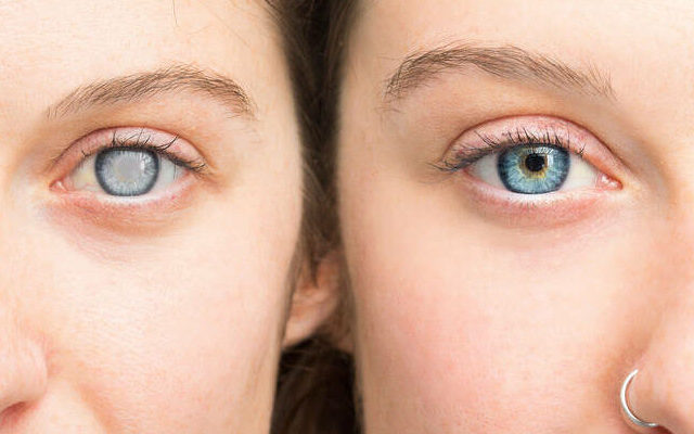 La contaminación del aire también puede dañar tus ojos: el riesgo que va más allá de los pulmones