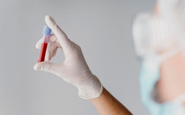 ¿Tienes hierro bajo aunque no tengas anemia? La nueva guía médica cambia el umbral